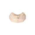 implant ပြန်လည်ထူထောင်ရေးကြွေးမြီသရဖူ